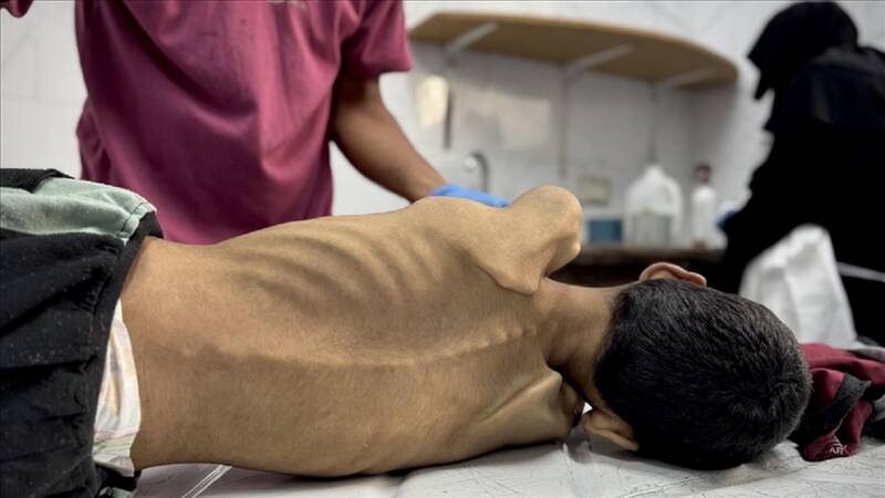 جان باختن ۶۰ کودک فلسطینی بر اثر سوءتغذیه 1 جان باختن ۶۰ کودک فلسطینی بر اثر سوءتغذیه